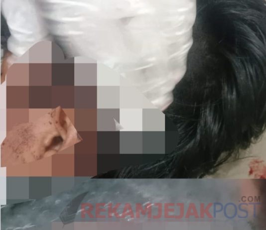 Diduga Pihak Polsek Jati Agung Tidak Serius Menangani Kasus Pengeroyokan dan Penganiayaan Anak Dibawah Umur